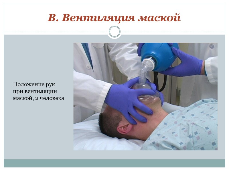 B. Вентиляция маской Положение рук при вентиляции  маской, 2 человека